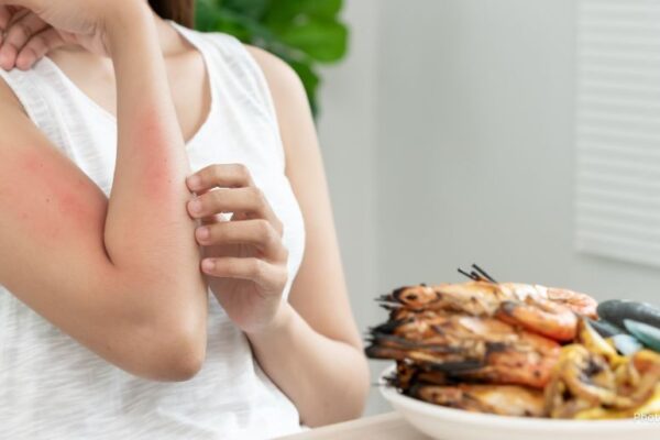 What Drives Food Allergies New Study Pinpoints Early Life Factors That Raise Risk