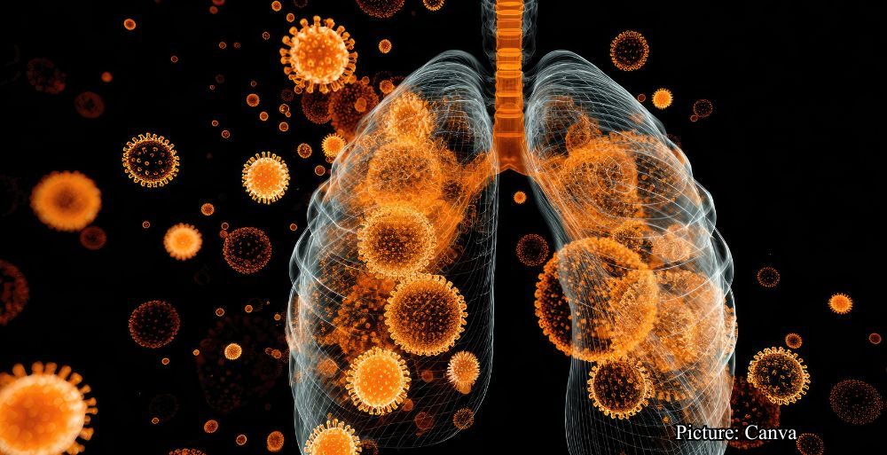 GNN Respiratory Virus HMPV Spreads Across Northern California and Multiple Regions