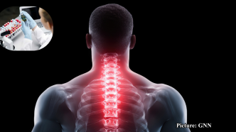 GNN NIH Researchers Unveil New Opioid Compound That Could Revolutionize Pain Management