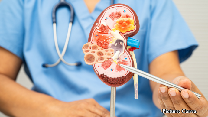 GNN The Importance of Morning Water Consumption for Kidney Health