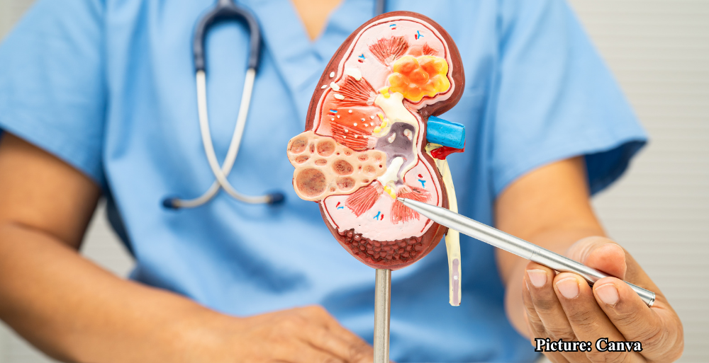 GNN The Importance of Morning Water Consumption for Kidney Health