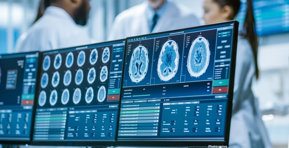 Photo Neuroscientists Discover New Form of Neuroplasticity Enhancing Learning from Single Experiences