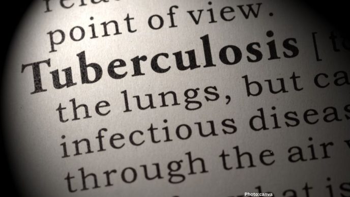AI Tool Enhances Tuberculosis Detection in Haryana