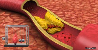 National Medical Organizations Issue Stricter Cholesterol Guidelines Lowering LDL Targets for Cardiovascular Prevention