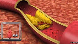 National Medical Organizations Issue Stricter Cholesterol Guidelines Lowering LDL Targets for Cardiovascular Prevention