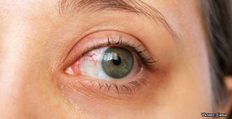 Increased Screen Time Linked to Rising Incidence of Dry Eye Syndrome