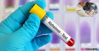 FDA Approves Blood Test for Early Detection of Alzheimer's Disease