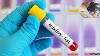 FDA Approves Blood Test for Early Detection of Alzheimer's Disease