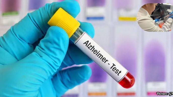 FDA Approves Blood Test for Early Detection of Alzheimer's Disease