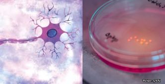 Harvard and Yale Researchers Receive $46 Million Grant to Study Autism and Brain Development