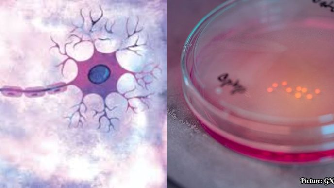 Harvard and Yale Researchers Receive $46 Million Grant to Study Autism and Brain Development