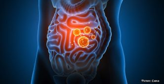 Johns Hopkins Study Reveals Mechanism Behind Inflammation, Paving Way for New Treatments