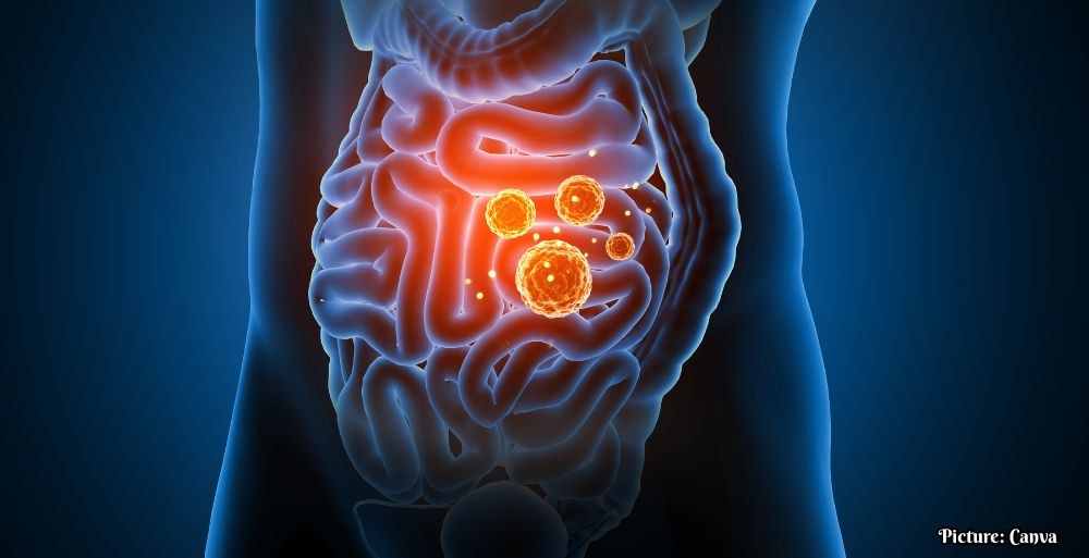 Johns Hopkins Study Reveals Mechanism Behind Inflammation, Paving Way for New Treatments