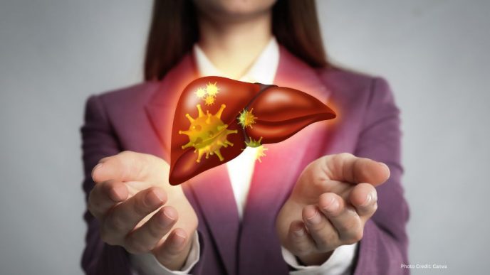 Dietary Choices Impacting Liver Health: Best and Worst Foods