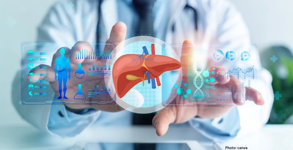 Comprehensive Guide to Managing Fatty Liver Disease Through Diet and Lifestyle Changes